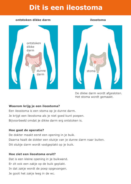 Praatkaart ileostoma