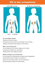 Praatkaart urinestoma